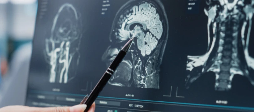 Baltimore Traumatic Brain Injury Lawyer